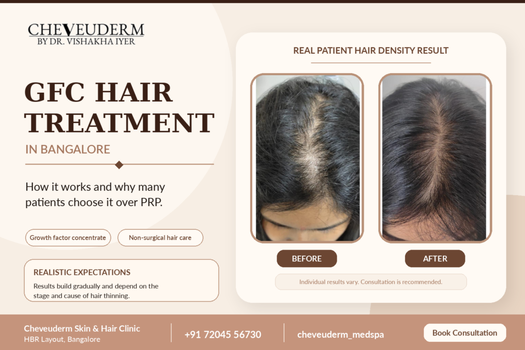 GFC hair treatment in Bangalore showing real patient improvement in hair density