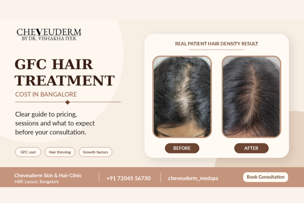 GFC hair treatment in Bangalore at Cheveuderm for hair thinning and improved hair density